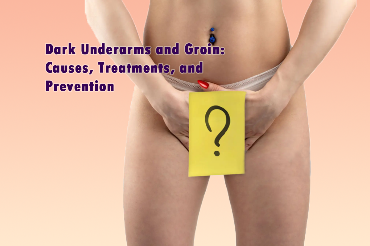 Causes of Dark Underarms